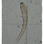 무궁화 점무늬병